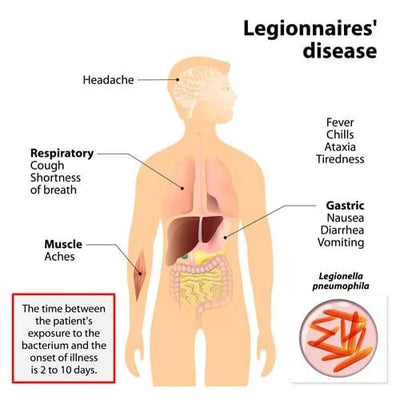 Legionaire's Disease